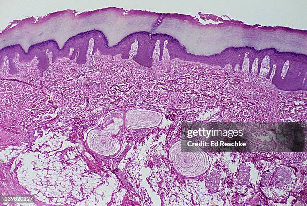 pacinian corpuscles; sensory receptors in skin (subcutaneous layer), 10x at 35mm. three pacinian corpuscles are seen in the subcutaneous layer of thick skin. these receptors have a layered nature. they detect deep pressure & vibrations - human skin cell stock pictures, royalty-free photos & images