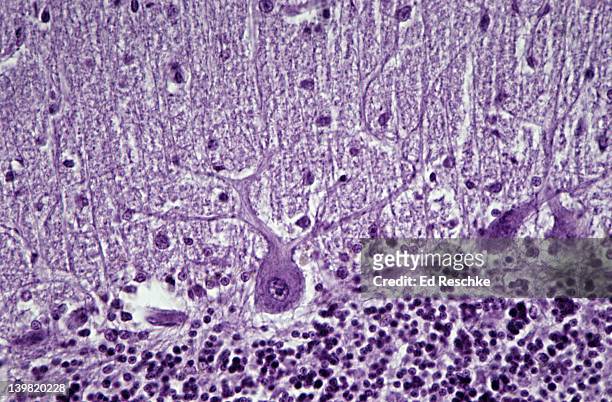purkinje cell (neuron); cerebellum, 100x at 35mm. shows: cell body, nucleus, nucleolus, and branching dendrites. human cerebellum. - medulla stock-fotos und bilder
