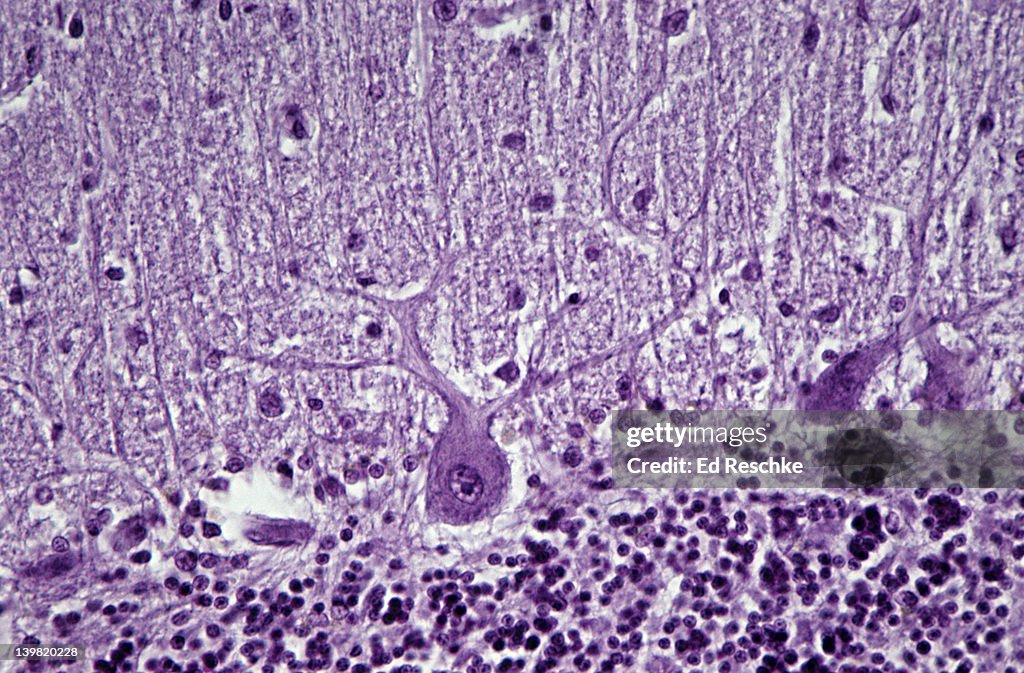 Purkinje cell (neuron); cerebellum, 100X at 35mm. Shows: cell body, nucleus, nucleolus, and branching dendrites. Human cerebellum.
