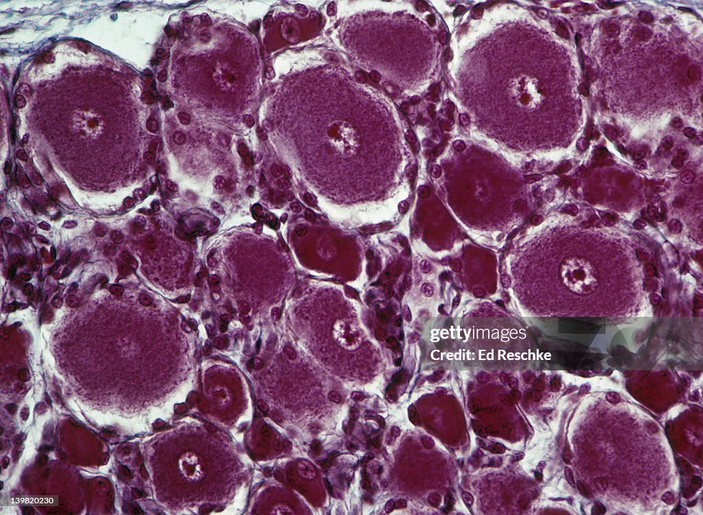 Ganglion; dorsal root, spinal cord, sensory neuron cell bodies 100X at 35mm. Shows: masses of sensory neuron cell bodies, nuclei, and nucleoli.