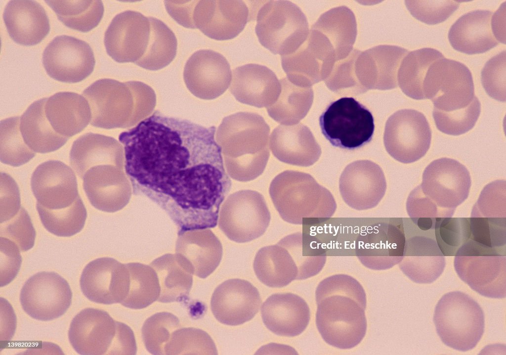 Monocyte & lymphocyte; white blood cells (leukocytes), 400X at 35mm. Human blood smear (Wright s stain). The monocyte is the largest WBC, is phagocytic, and transforms into a macrophage in the tissues. The lymphocyte is a very important immune syste