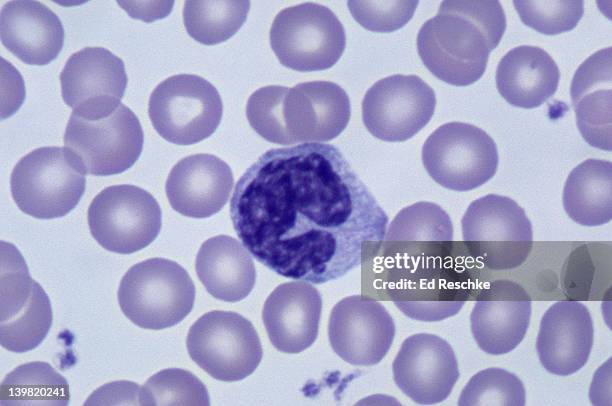 monocyte; white blood cell (leukocyte), 500x at 35mm. human blood smear (wright s stain). largest leukocyte. has horseshoe-shaped nucleus. excellent phagocyte. leaves blood stream & transforms into a macrophage in tissues. also shows red blood cells - platelet stock-fotos und bilder