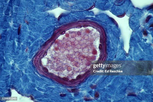 small vein (venule). cross section, 250x at 35mm. shows: tunica intima (with endothelium), tunica media (smooth muscle), tunica adventitia (blue, connective tissue). red blood cells are shown in the lumen. - venula foto e immagini stock