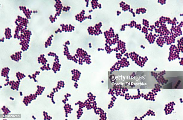staphylococcus aureus, gram positive spherical bacteria, 500x at 35mm. spherical cells (cocci) arranged in grapelike clusters. many resistant strains of staph have evolved. different strains can cause: skin infections, food poisoning and toxic shock - stafylokokken stockfoto's en -beelden