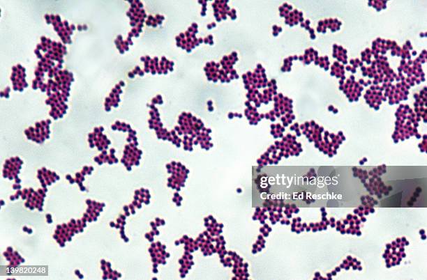 staphylococcus aureus, gram positive spherical bacteria, 500x at 35mm. spherical cells (cocci) arranged in grapelike clusters. many resistant strains of staph have evolved. different strains can cause: skin infections, food poisoning and toxic shock - estafilococo imagens e fotografias de stock