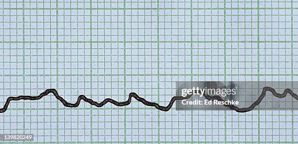 ventricular fibrillation, abnormal electrocardiogram (ecg). the normal sinus rhythm & waves are missing. this abnormal & bizarre electrical activity reflects the erratic & uncoordinated activity of the heart, the heart is quivering. all circulation  - heart ventricle bildbanksfoton och bilder