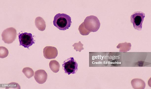 Imtamure Rbc Immature Red Blood Cell Photos and Premium High Res Pictures - Getty Images