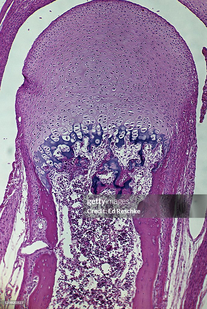 Developing bone. Endochondral ossification with epiphyseal disk, 25X at 35mm. Shows: epiphyseal disk, hyaline cartilage, calcified cartilage, osteoblasts, mesenchyme, osteocytes. Cartilage bone, phalanx, monkey.