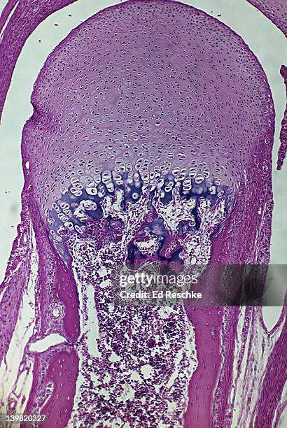 developing bone. endochondral ossification with epiphyseal disk, 25x at 35mm. shows: epiphyseal disk, hyaline cartilage, calcified cartilage, osteoblasts, mesenchyme, osteocytes. cartilage bone, phalanx, monkey. - osteocyte stock pictures, royalty-free photos & images