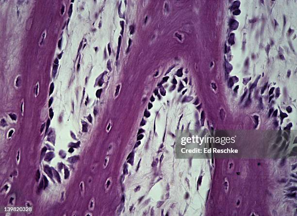 developing bone. osteoblasts & osteocytes, 100x at 35mm shows: osteoblasts (on surface of bony spicules), osteocytes (in lacunae) and spongy bone. endochondral ossification (cartilage bone). - osteocyte stock pictures, royalty-free photos & images