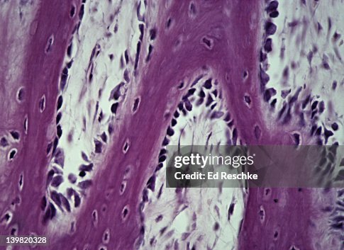 Developing bone. Osteoblasts & osteocytes, 100X at 35mm Shows: osteoblasts (on surface of bony spicules), osteocytes (in lacunae) and spongy bone. Endochondral ossification (cartilage bone). Developing bone. Osteoblasts & osteocytes, 100X at 35mm Shows: osteoblasts (on surface of bony spicules), osteocytes (in lacunae) and spongy bone. Endochondral ossification (cartilage bone).