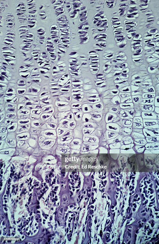 Epiphyseal disk. Developing bone, endochondral ossification, 50X at 35mm. Shows: epiphyseal disk, hyaline cartilage, osteoblasts, calcified cartilage, newly formed bone.