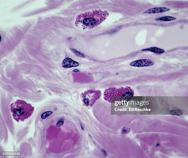 mast cells in connective tissue, 250x at 35mm. shows: four mast cells with reddish granules; release heparin & histamine. histamine is associated with inflammation & allergies. widely distributed in connective tissue. - mastocyte stock pictures, royalty-free photos & images