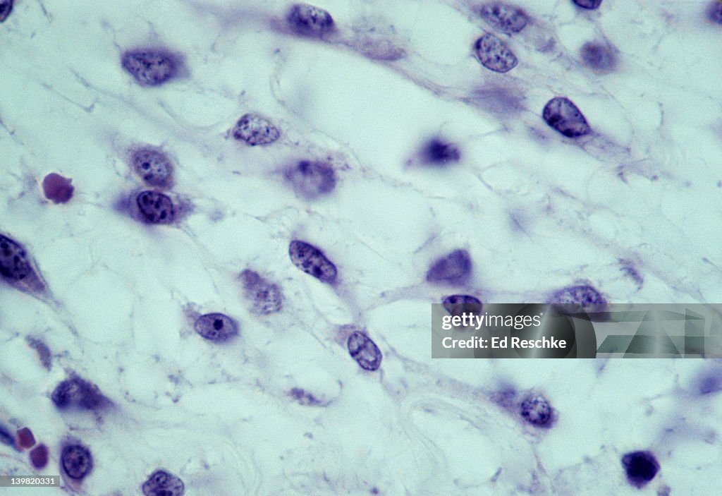 Mesenchyme. Mesenchymal (stem) cells, embryonic connective tissue, 250X at 35mm. Shows: mesenchymal cells, fluid ground substance, and fibers.