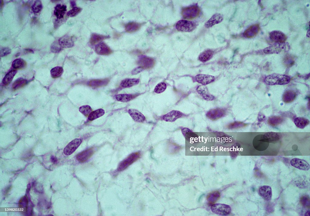 Mesenchyme. Mesenchymal (stem) cells, embryonic connective tissue, 250X at 35mm. Shows: mesenchymal cells, fluid ground substance, and fibers.