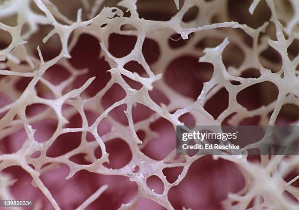 spongy (cancellous) bone. site of the red bone marrow. shows the trabeculae (bony network), red marrow fills the spaces. - bone tissue stock-fotos und bilder