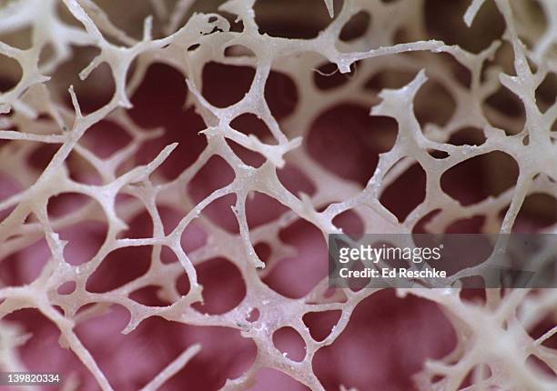 spongy (cancellous) bone. site of the red bone marrow. shows the trabeculae (bony network), red marrow fills the spaces. - beenmerg bot stockfoto's en -beelden