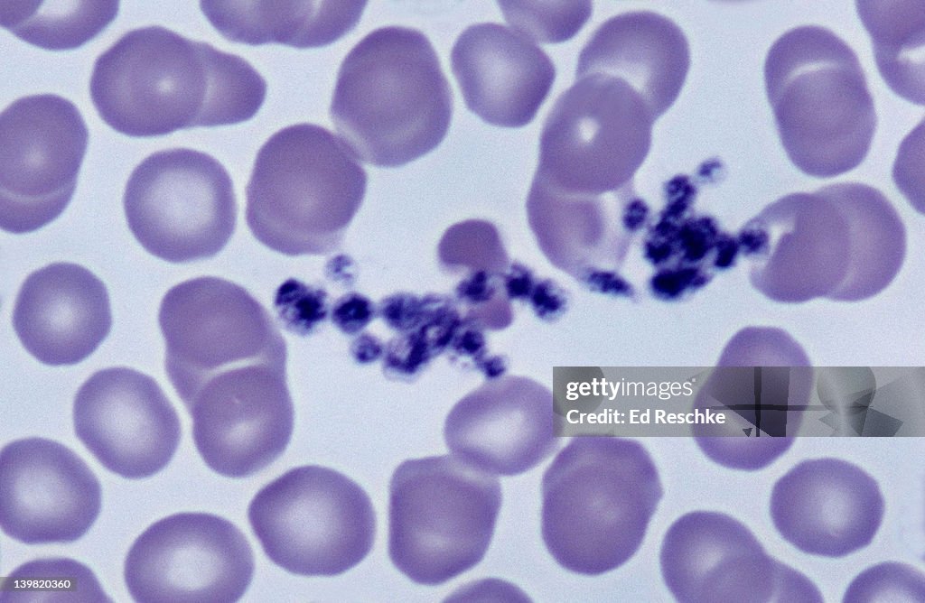 Red blood cells (erythrocytes) & platelets, 500X at 35mm. The platelets are stained purple and many are clumped together. This happens when platelets become sticky and initiate a clot.