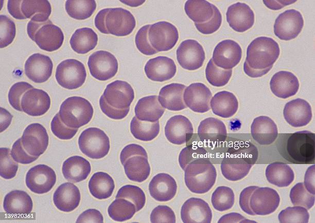 red blood cells (erythrocytes). 400x at 35mm. human blood smear (wrights stain). shows: rbcs and two platelets (thrombocytes). the central pallor of the rbcs relates to the absence of a nucleus & thinness in the center. - platelet stock-fotos und bilder
