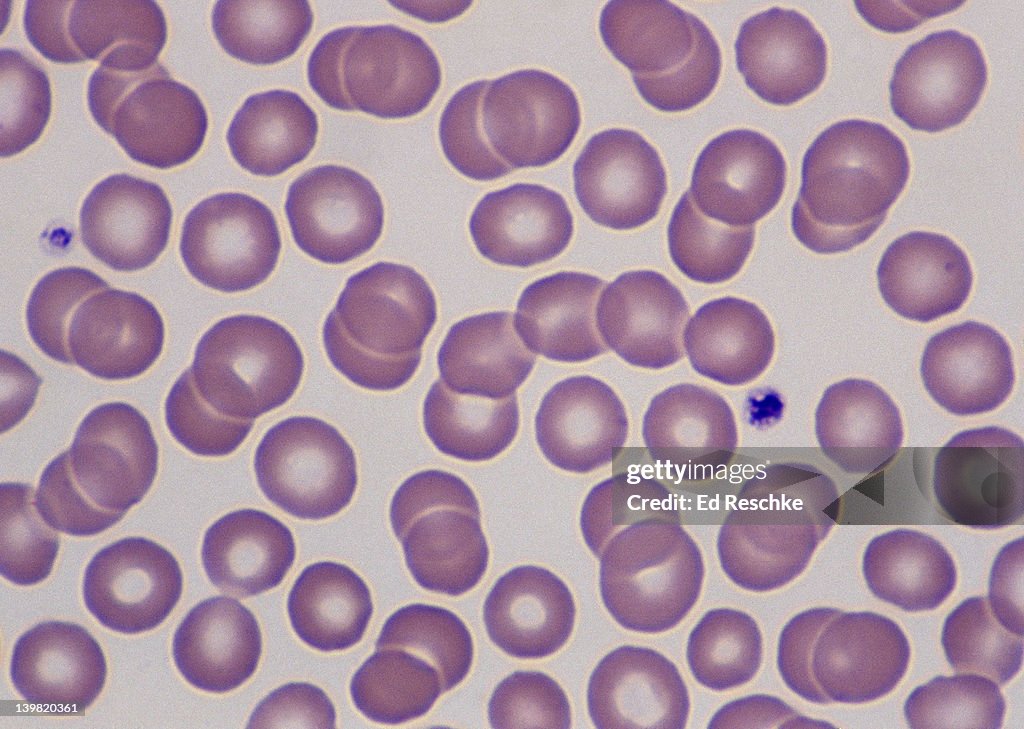 Red Blood Cells The Central Pallor Of The Rbcs Relates To The Absence ...