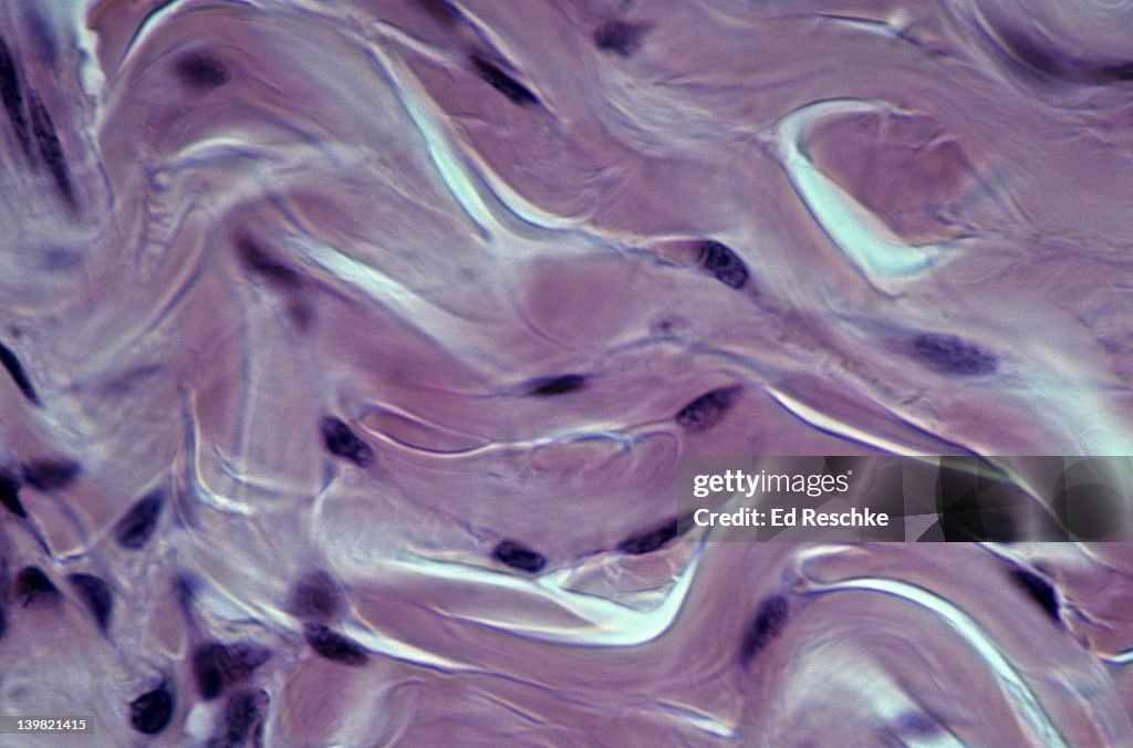 Dense fibrous connective tissue; irregular, dermis. 250X at 35mm. Shows: collagenous fibers (pink, irregular), and fibroblasts (purple). Fibroblasts are the cells that produce all of the collagenous fibers. Very tough connective tissue.