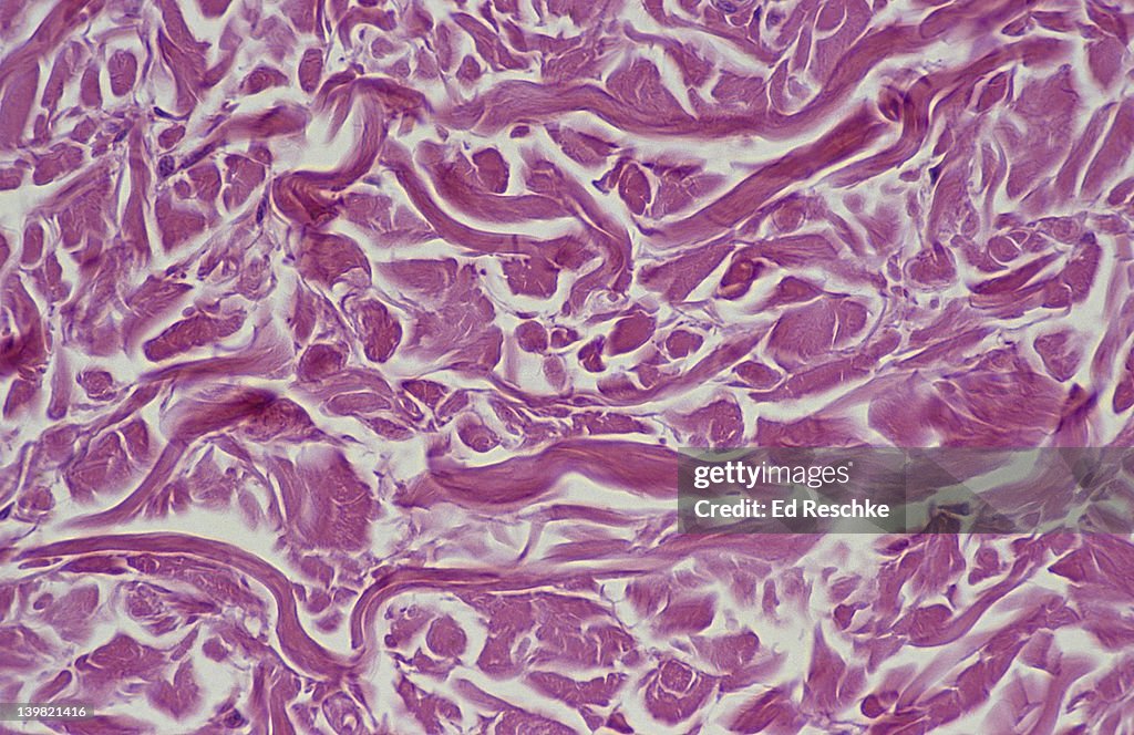 Dense fibrous connective tissue; irregular, 100X at 35mm. Shows: collagenous fibers and fibroblasts (cells that produce the fibers).