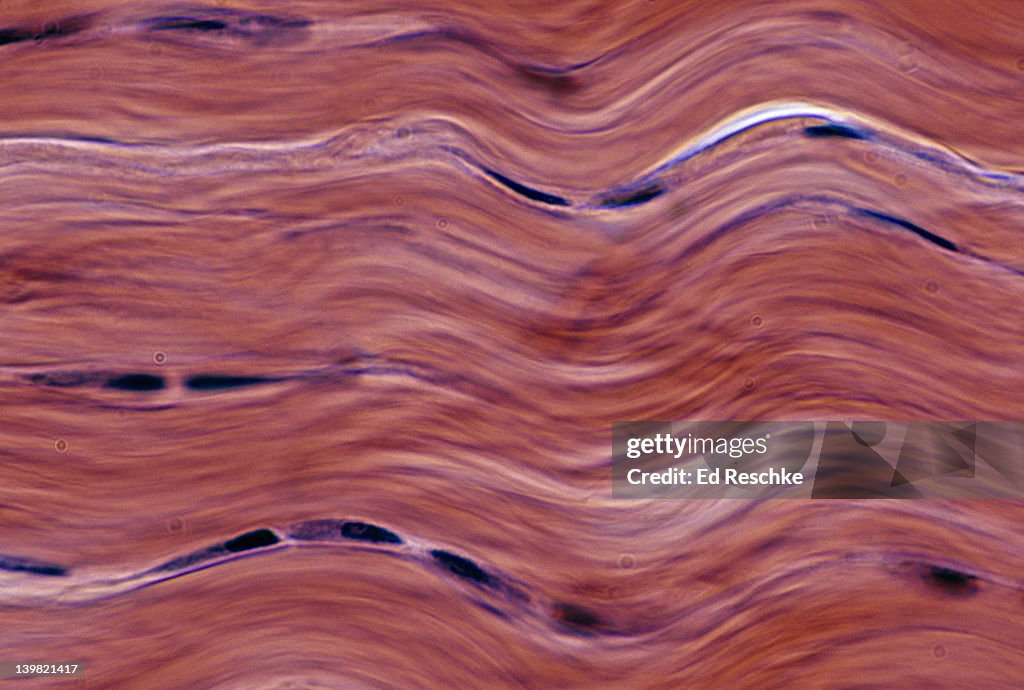 Dense fibrous connective tissue; regular, tendon, 250X at 35mm. Shows: collagenous fibers (tightly packed, in parallel arrays), and fibroblasts (also in parallel arrays). Tendons have high tensile strength.
