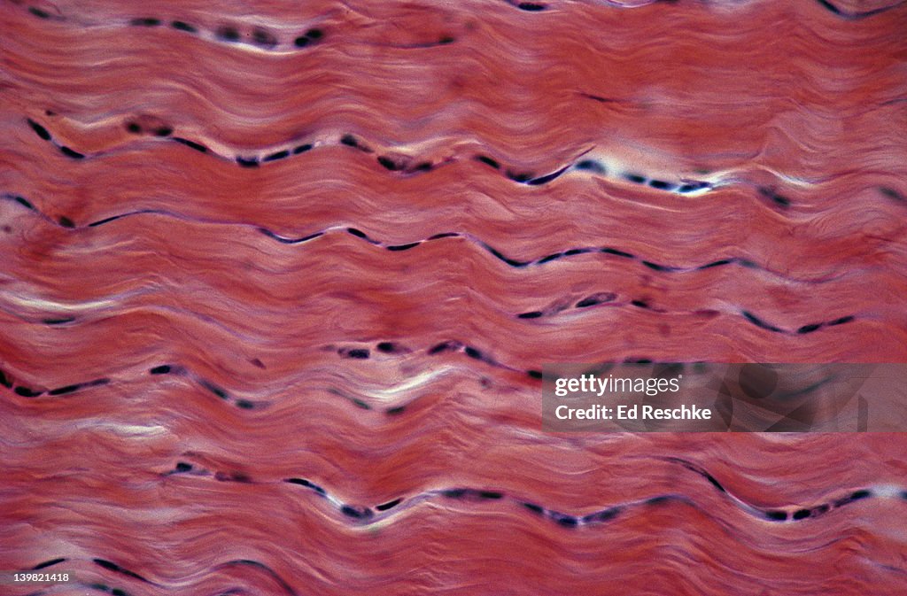 Dense Fibrous Connective Tissue Diagram Vrogue co dense-fibrous-connective-tissue-diagram-vrogue-co