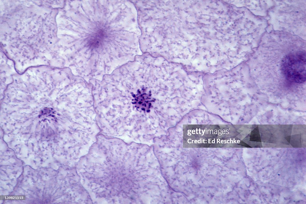 Realistic Prophase Prophase Of Mitosis