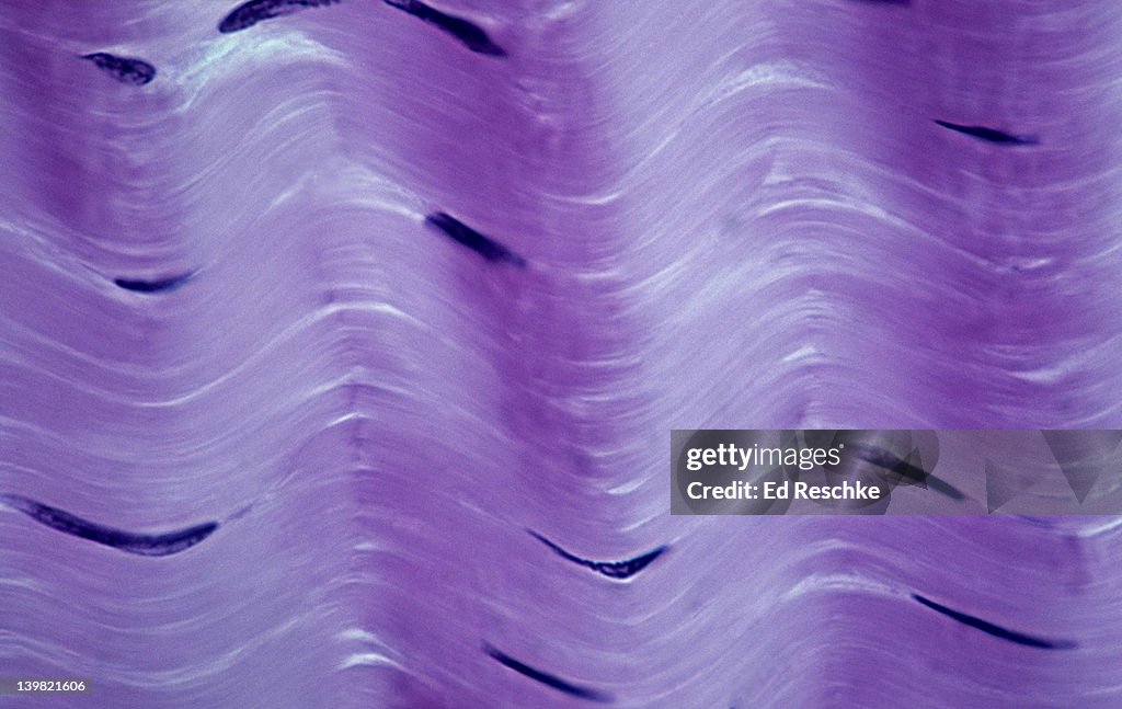 Dense fibrous connective tissue; regular, tendon, 250X at 35mm. Shows: collagenous fibers (pink, in parallel arrays), and fibroblasts (flat, dark structures). which produce the fibers. Collagenous fibers & tendons have high tensile strength