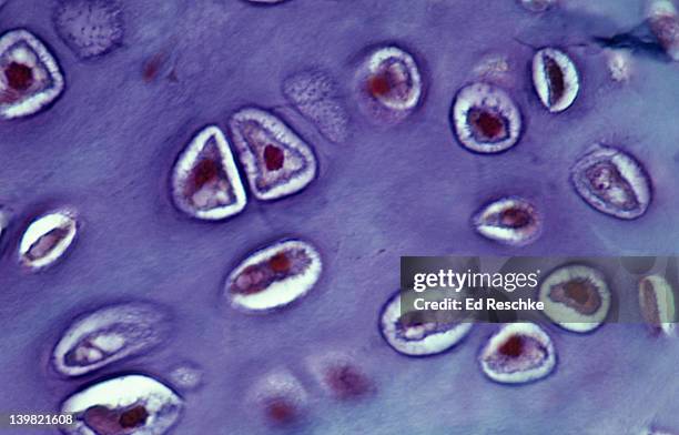 Hyaline Inclusions 76 Hyaline Cartilage Connective Tissue Stock Photos, High-Res Pictures ...