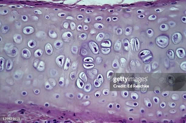 hyaline cartilage; supporting connective tissue, bronchus. 100x at 35mm. shows: chondrocytes (cartilage cells), matrix (intercellular material), lacunae, and perichondrium. - cartílago fotografías e imágenes de stock