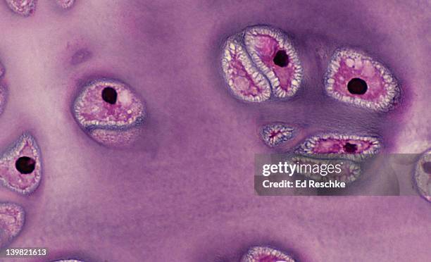Hyaline Inclusions Hyaline Cartilage Connective Tissue Photos and Premium High Res ...