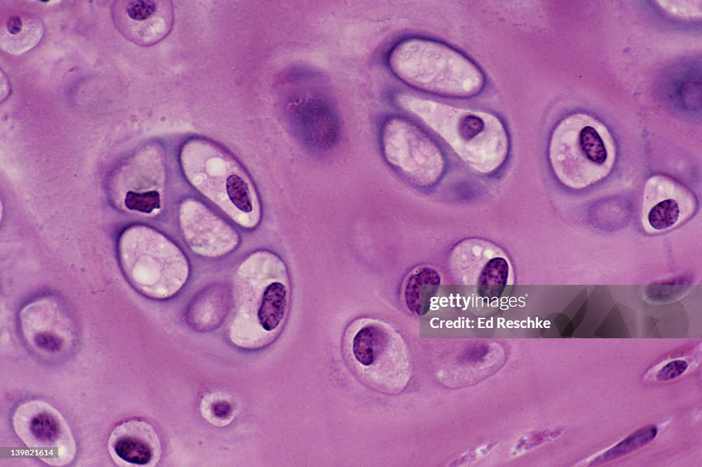 Hyaline cartilage; tracheal cartilage, supporting connective tissue, 250X at 35mm. Shows: Chondrocytes (cartilage cells), and matrix (intercellular material, non-living).