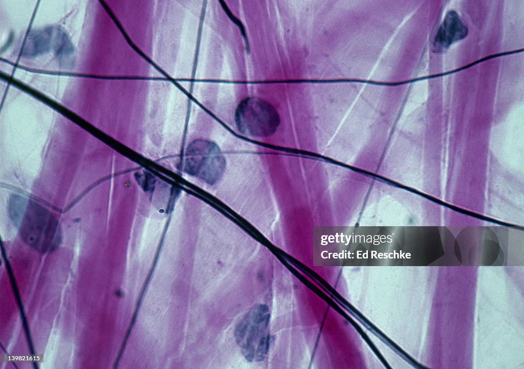 Loose (or areolar) connective tissue. 250X at 35mm. Shows: collagenous fibers (red), elastic fibers (black), matrix, and fibroblasts (cells that produce the fibers.