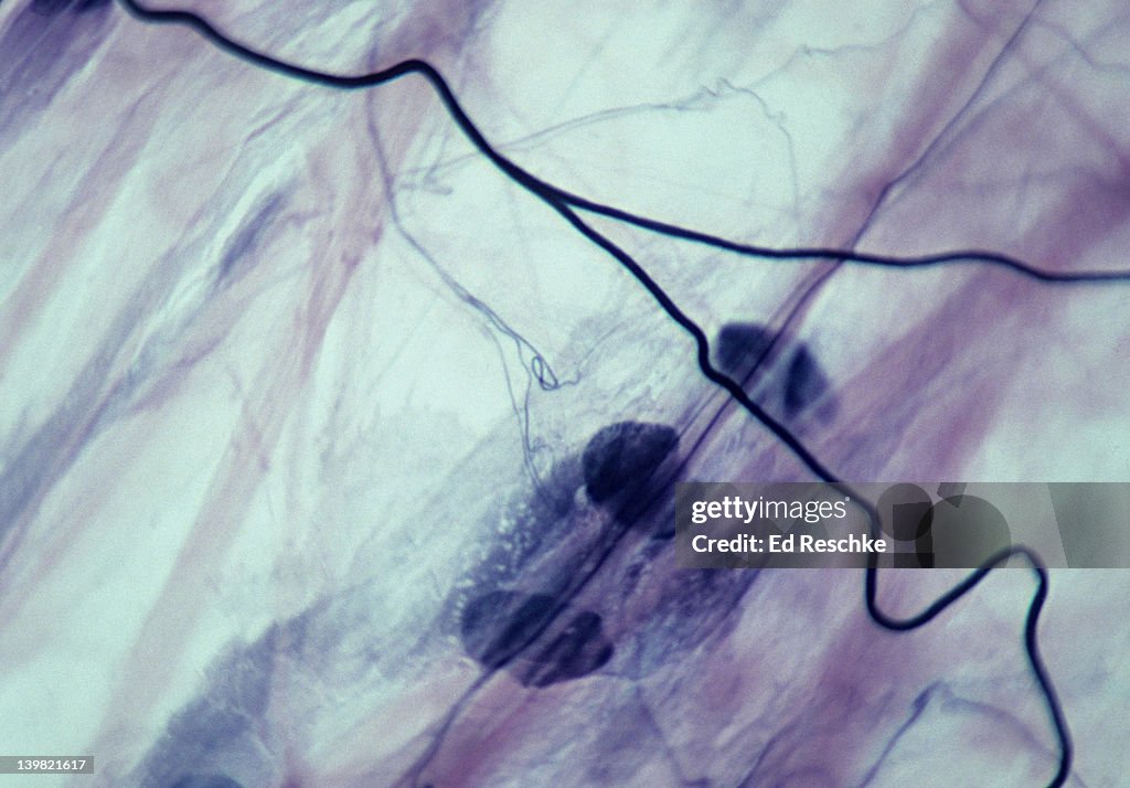 Loose (or areolar) connective tissue. 250X at 35mm. Shows: collagenous fibers (pink), elastic fibers (black), matrix, and fibroblasts (cells that produce the fibers).