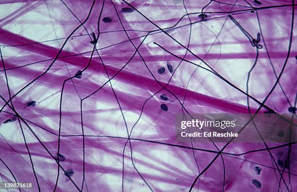 loose (or areolar) connective tissue. 100x at 35mm. shows: collagenous fibers (red), elastic fibers (black), matrix, fibroblasts (cells that produce the fibers). - areolar connective tissue stock pictures, royalty-free photos & images