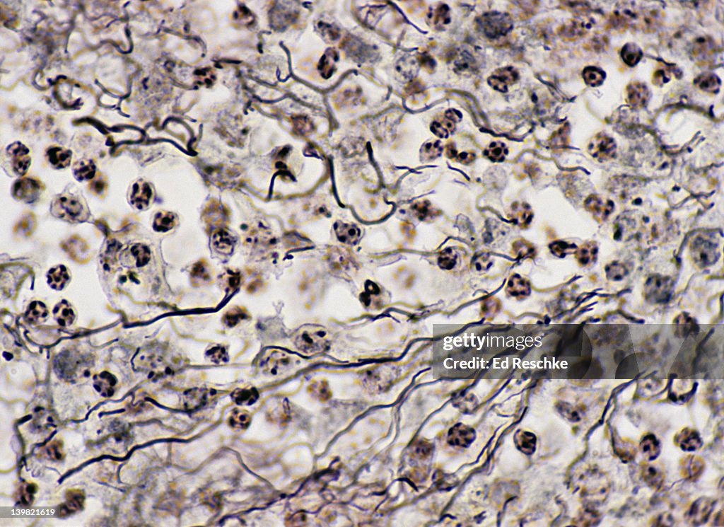 Reticular connective tissue; lymph node, 250X at 35mm. Shows: a network of reticular fibers (black) that provides a supporting framework for soft organs like the spleen, liver and lymph nodes. Silver stain.