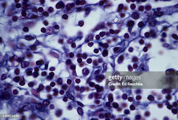 reticular connective tissue; lymph node, 250x at 35mm. shows a network of reticular fibers (purple) that provides a supporting framework for soft organs like the spleen, liver & lymph nodes. - lymphatic system stock pictures, royalty-free photos & images