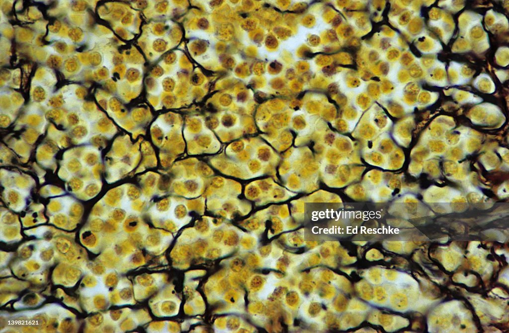 Reticular connective tissue; spleen, 250X at 35mm. Shows: a network of reticular fibers (black) that provides a supporting framework for soft organs like the spleen, liver and lymph nodes.