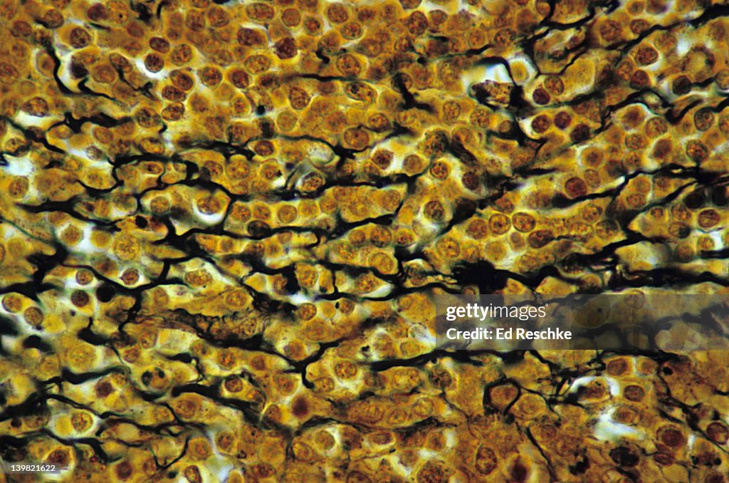 Reticular connective tissue; spleen, 250X at 35mm. Shows: a network of reticular fibers (black) that provides a supporting framework for soft organs like the spleen, liver & lymph nodes.