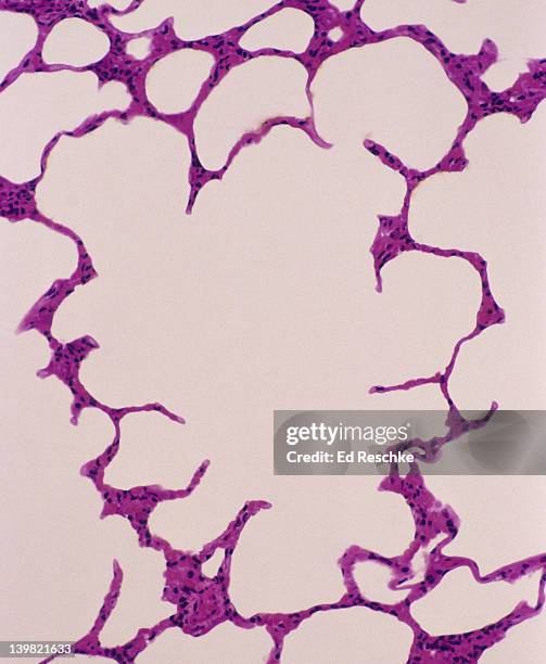 alveolar (air) sac, alveoli, normal lung tissue, 50x at 35mm. shows a single large alveolar (or air) sac and many alveoli. the alveolar walls are composed of simple squamous epithelium. - simple squamous epithelium stock-fotos und bilder