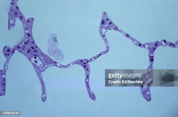 alveolar macrophage (phagocyte) & alveoli. normal human lung tissue, 100x at 35mm. shows single macrophage in alveolus, thin alveolar wall, red blood cells in pulmonary capillaries, & the extremely thin respiratory membrane for gas exchange. - macrophage stock pictures, royalty-free photos & images