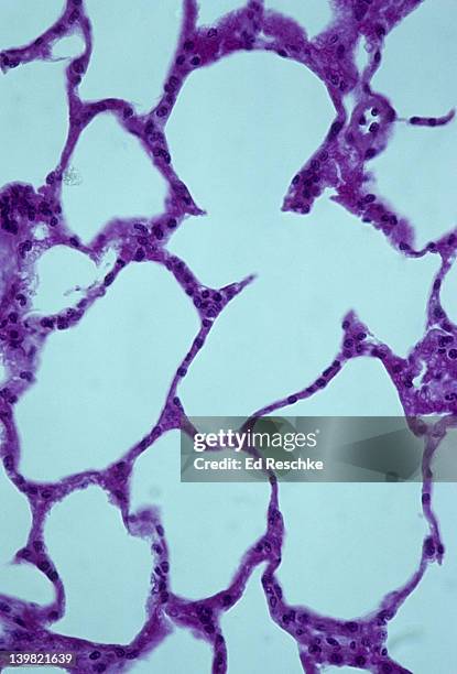 alveoli & alveolar (air) sacs. normal lung tissue, 100x at 35mm. shows alveoli and thin alveolar walls, composed of simple squamous epithelium adapted for gas exchange. - simple squamous epithelium fotografías e imágenes de stock