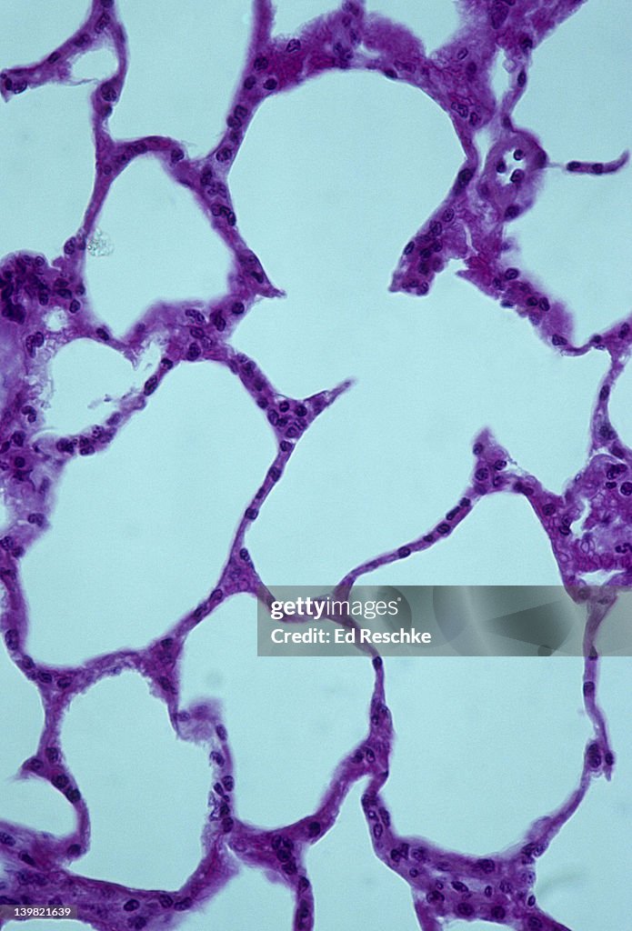Alveoli & alveolar (air) sacs. Normal lung tissue, 100X at 35mm. Shows alveoli and thin alveolar walls, composed of simple squamous epithelium adapted for gas exchange.
