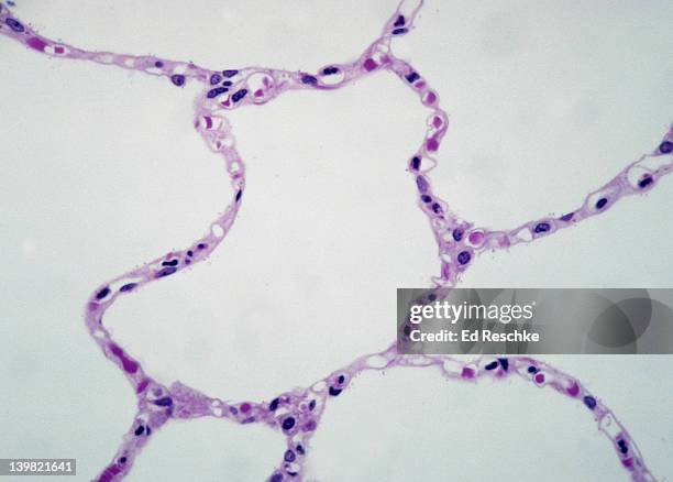 alveoli. normal human lung tissue, 100x at 35mm. shows: alveoli, thin alveolar walls (simple squamous epithelium) adapted for gas exchange, red blood cells within the pulmonary capillaries, and the extremely thin respiratory membrane. - 毛細血管 ストックフォトと画像