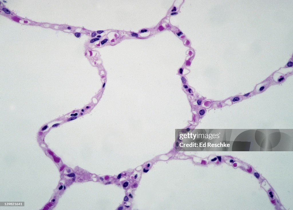 Alveoli. Normal human lung tissue, 100X at 35mm. Shows: alveoli, thin alveolar walls (simple squamous epithelium) adapted for gas exchange, red blood cells within the pulmonary capillaries, and the extremely thin respiratory membrane.