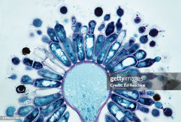 aspergillus (mold). conidia & conidiophores, 250x at 35mm. the circular structures are conidia (spores) that pinch off. asexual reproduction. aspergillus is a deuteromycet. - immunofluorescentie microfoto stockfoto's en -beelden
