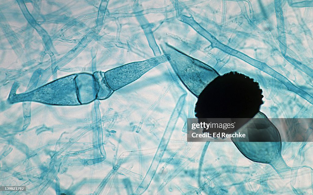 Black bread mold, Rhizopus stolonifer. Sexual Reproduction, Zygospore & Gametangia, 50X at 35mm. Shows: gametangia and gametes (left), zygospore and zygosporangium (right). Kingdom Fungi, Phylum Zygomycota.