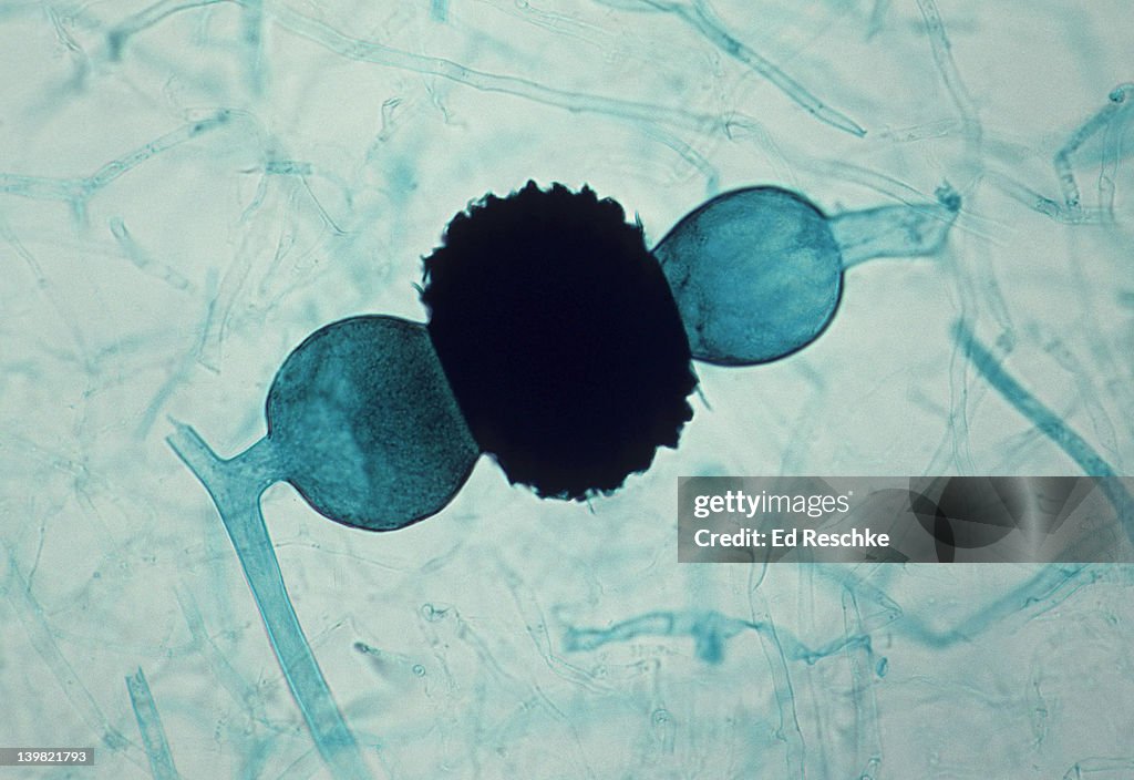 Black bread mold. Rhizopus stolonifer, Zygospore & Zygosporangium, 50X at 35mm. Sexual reproduction between different matiing types. Kingdom Fungi, Phylum Zygomycota.